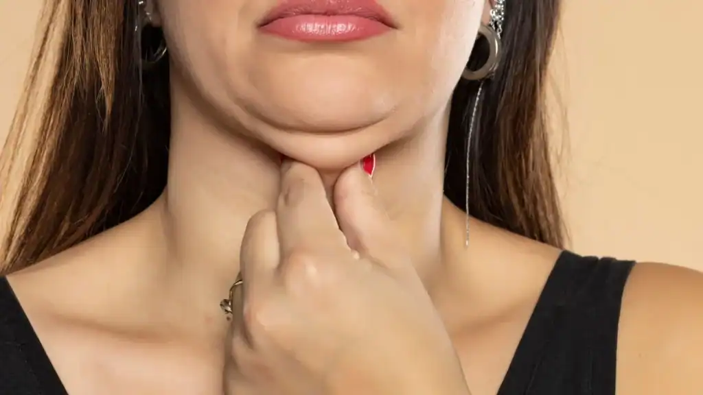An image of a woman with double chin, sad, worried : Non Surgical Double Chin Removal Treatment in Trowbridge, UK