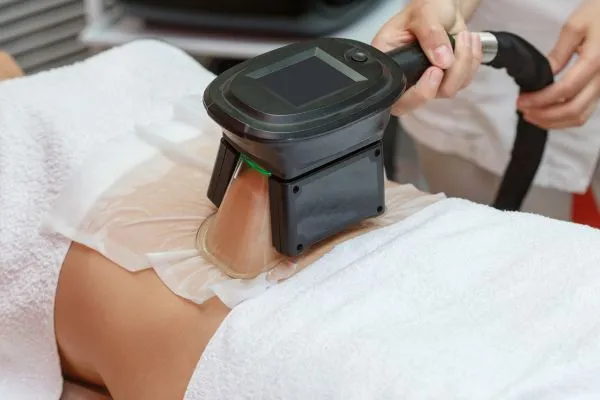 Image of person having fat freezing treatment to help weight gain Trowbridge