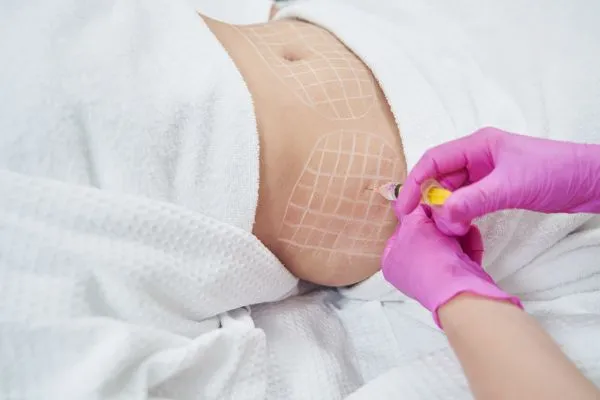 image of fat dissolving injections on love handles to help combat weight gain Trowbridge