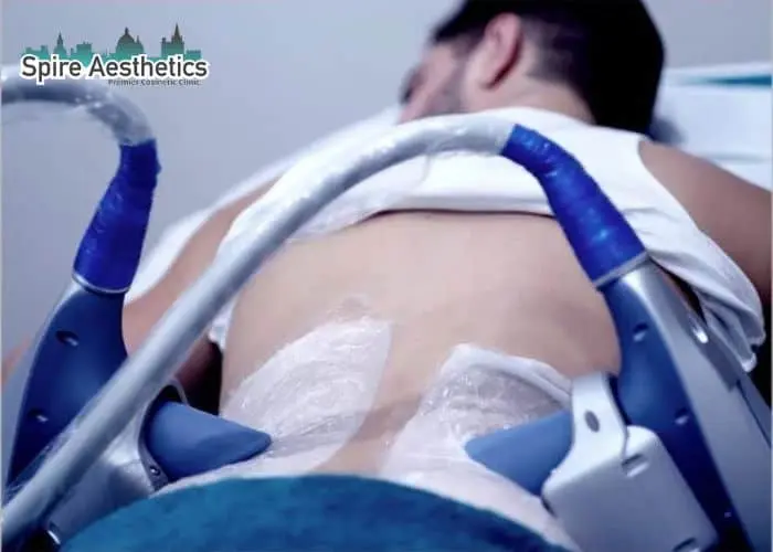 Man having fat freezing treatment done on love handles before a competitions Trowbridge to create a sculpted look.